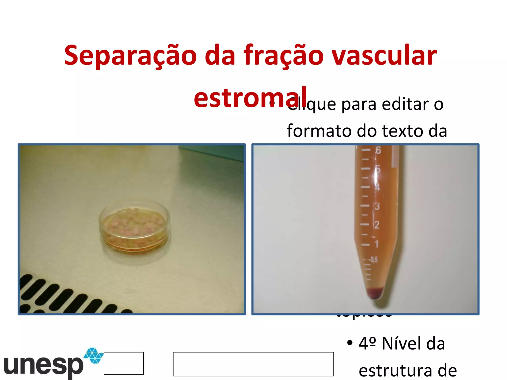 Separação da fração vascular estromal 