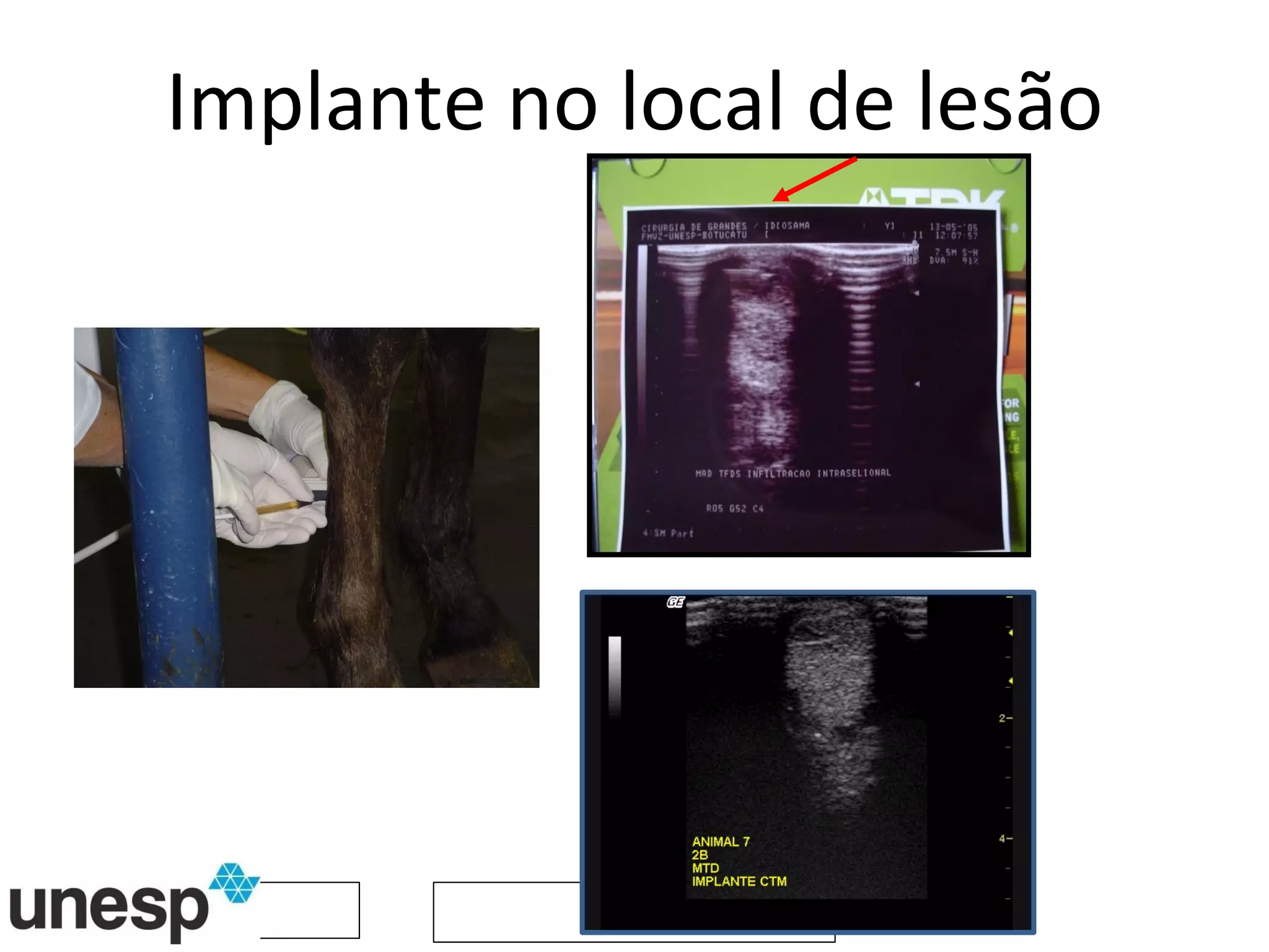 Implante no local de lesão 