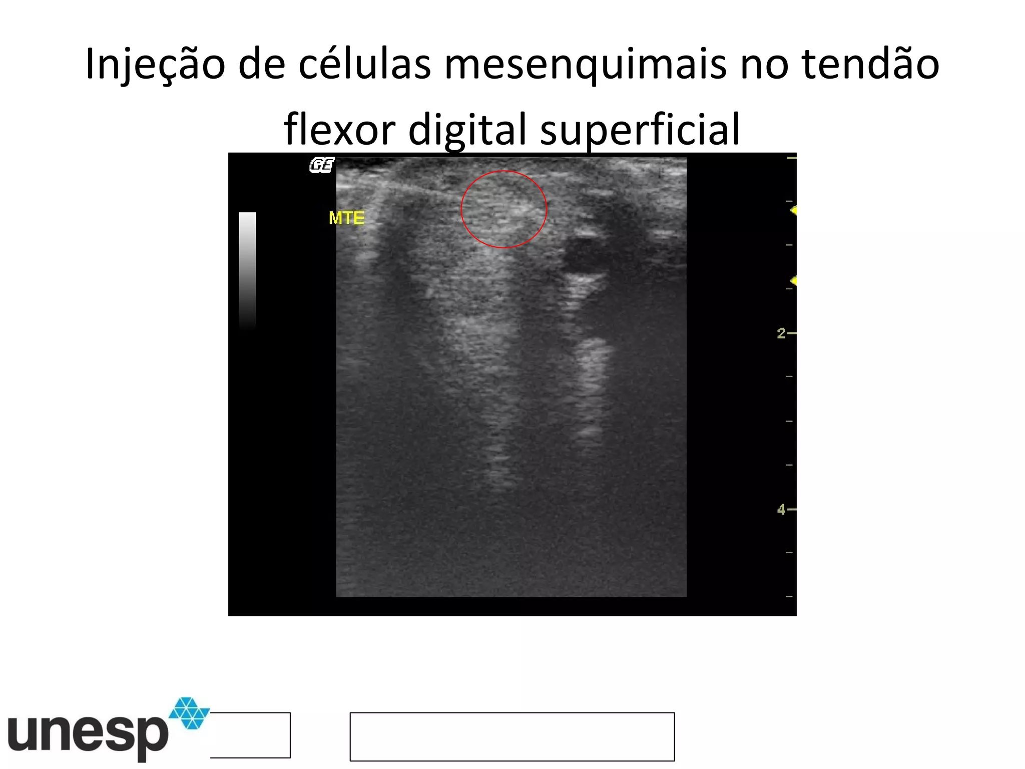 Injeção de células mesenquimais no tendão flexor digital superficial 