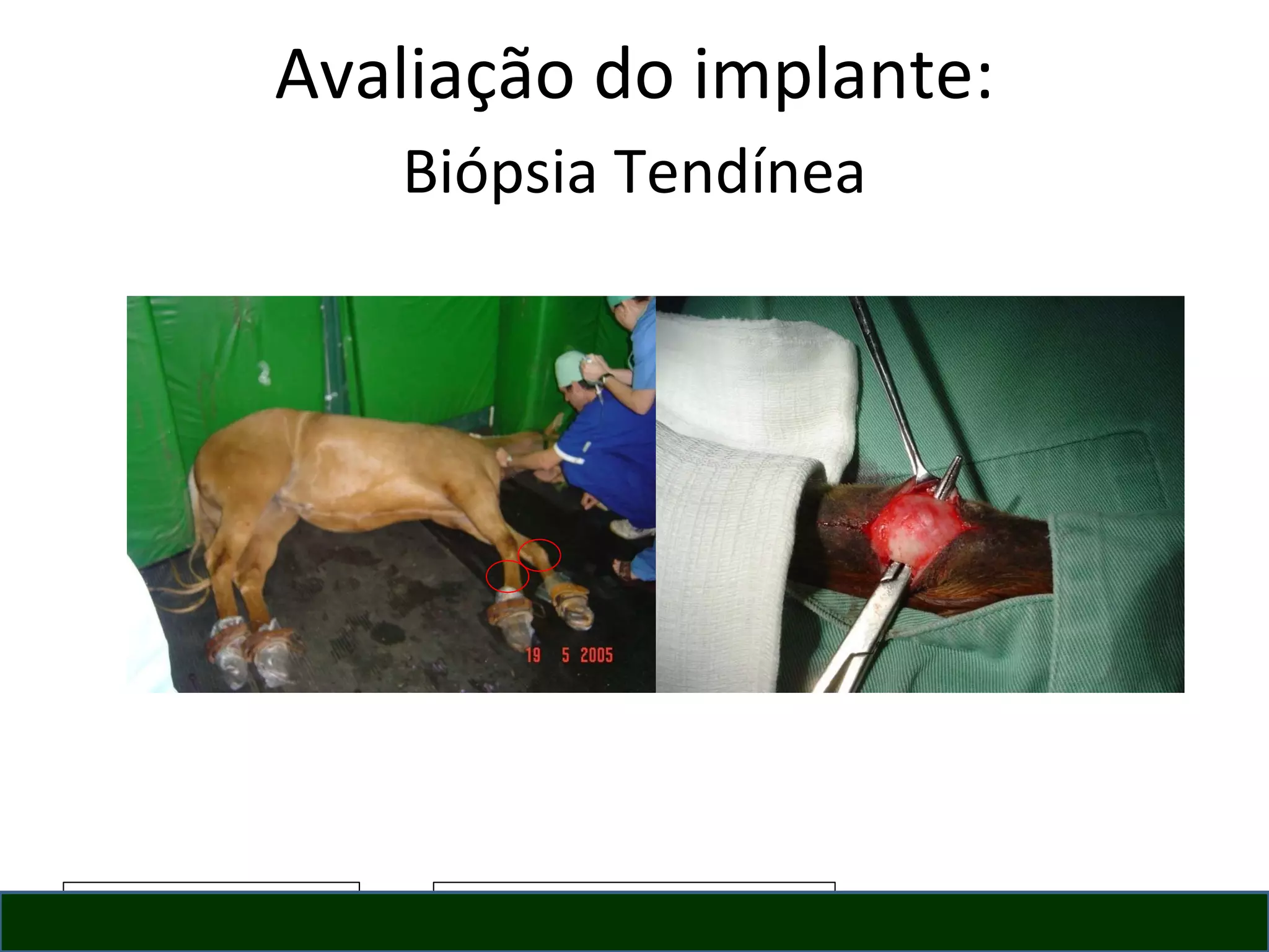 Avaliação do implante: Biópsia Tendínea 