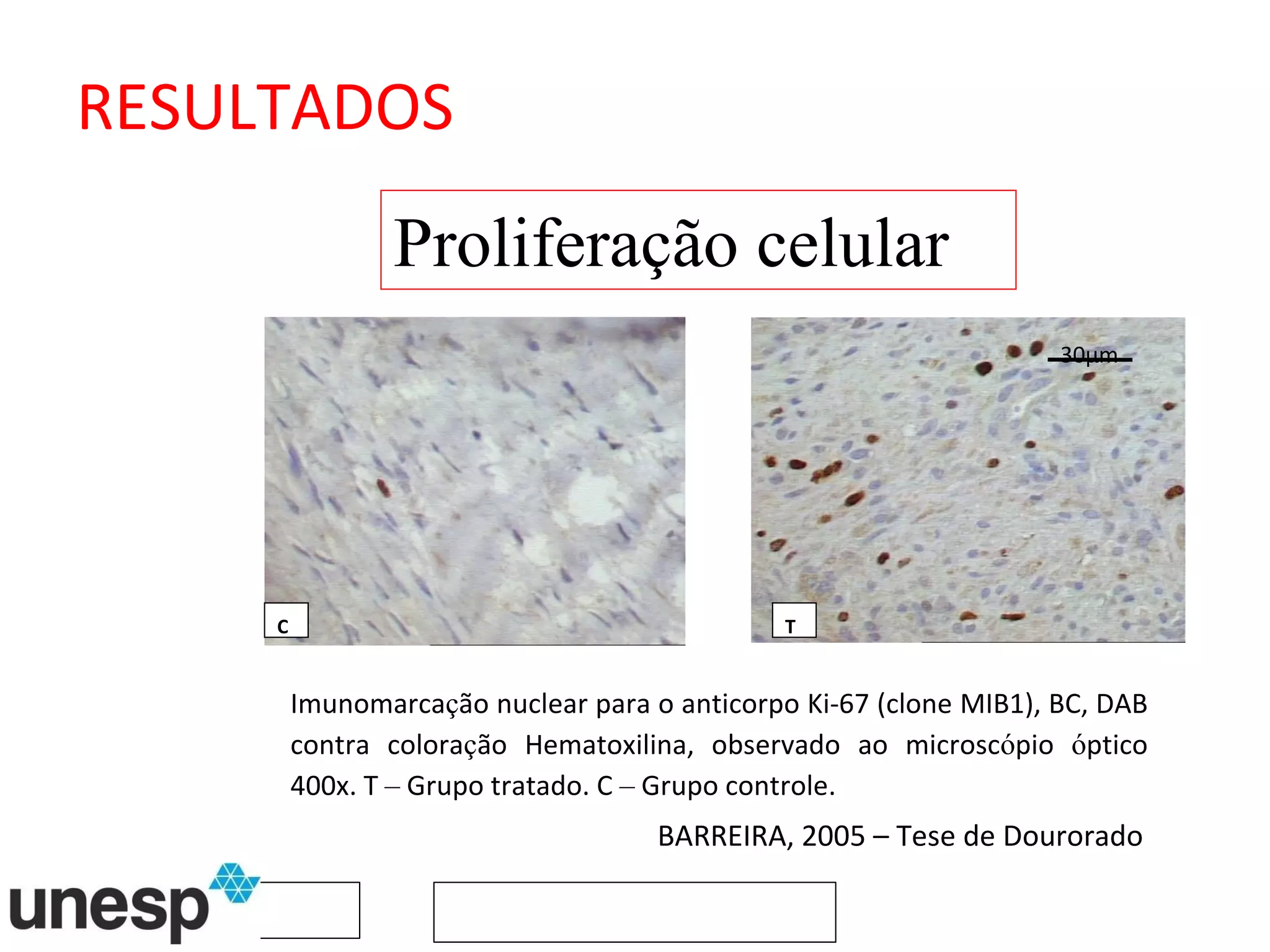 Imunomarca ç ão nuclear para o anticorpo Ki-67 (clone MIB1), BC, DAB contra colora ç ão Hematoxilina, observado ao microsc ó pio  ó ptico 400x. T  –  Grupo tratado. C  –  Grupo controle.  C T Proliferação celular BARREIRA, 2005 – Tese de Dourorado 30µm RESULTADOS 