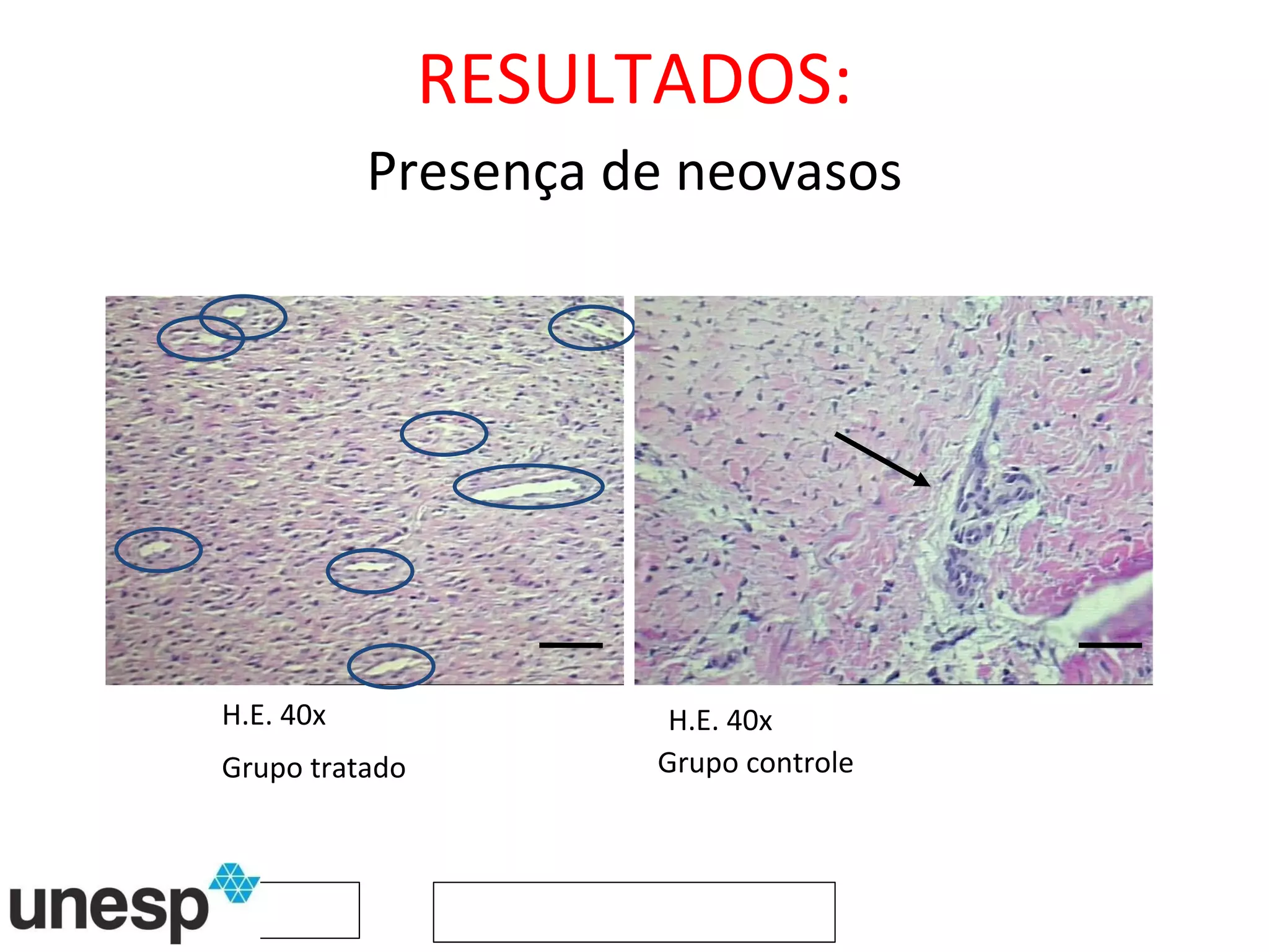RESULTADOS: Presença de neovasos H.E. 40x H.E. 40x Grupo tratado Grupo controle 