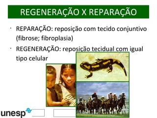 REGENERAÇÃO X REPARAÇÃO REPARAÇÃO: reposição com tecido conjuntivo (fibrose; fibroplasia) REGENERAÇÃO: reposição tecidual com igual tipo celular 