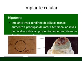 Implante celular Hipótese:  Implante intra-tendíneo de células-tronco aumente a produção de matriz tendínea, ao invés de tecido cicatricial, proporcionando um retorno a função estrutural tendínea. 