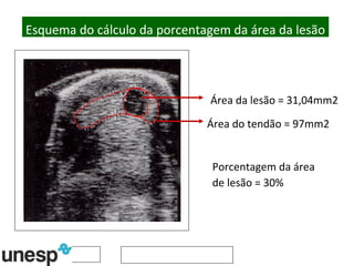 Área da lesão = 31,04mm2 Área do tendão = 97mm2 Porcentagem da área de lesão = 30% Esquema do cálculo da porcentagem da área da lesão 