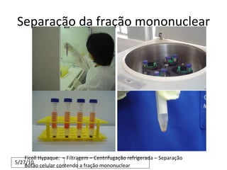Separação da fração mononuclear Ficoll Hypaque:  – Filtragem – Centrifugação refrigerada – Separação Botão celular contendo a fração mononuclear 