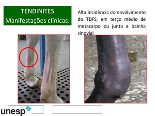 TENDINITES Manifestações clínicas: Alta incidência do envolvimento do TDFS, em terço médio de metacarpo ou junto a bainha sinovial  