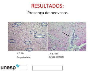 RESULTADOS: Presença de neovasos H.E. 40x H.E. 40x Grupo tratado Grupo controle 