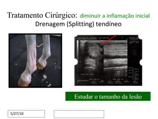 Tratamento Cirúrgico:   diminuir a inflamação inicial   Drenagem (Splitting) tendíneo Estudar o tamanho da lesão 