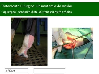 Tratamento Cirúrgico: Desmotomia do Anular -  aplicação : tendinite distal ou tenossinovite crônica 