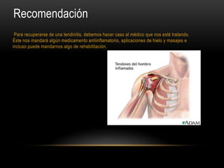 Recomendación
 Para recuperarse de una tendinitis, debemos hacer caso al médico que nos esté tratando.
Éste nos mandará algún medicamento antiinflamatorio, aplicaciones de hielo y masajes e
incluso puede mandarnos algo de rehabilitación.
 