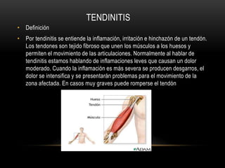 TENDINITIS
• Definición
• Por tendinitis se entiende la inflamación, irritación e hinchazón de un tendón.
  Los tendones son tejido fibroso que unen los músculos a los huesos y
  permiten el movimiento de las articulaciones. Normalmente al hablar de
  tendinitis estamos hablando de inflamaciones leves que causan un dolor
  moderado. Cuando la inflamación es más severa se producen desgarros, el
  dolor se intensifica y se presentarán problemas para el movimiento de la
  zona afectada. En casos muy graves puede romperse el tendón
 