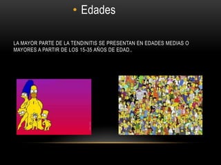 • Edades

LA MAYOR PARTE DE LA TENDINITIS SE PRESENTAN EN EDADES MEDIAS O
MAYORES A PARTIR DE LOS 15-35 AÑOS DE EDAD..
 