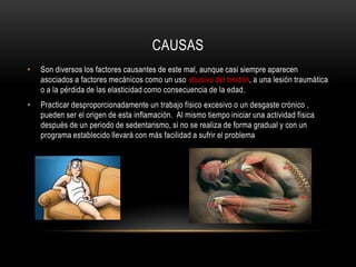 CAUSAS
•   Son diversos los factores causantes de este mal, aunque casi siempre aparecen
    asociados a factores mecánicos como un uso abusivo del tendón, a una lesión traumática
    o a la pérdida de las elasticidad como consecuencia de la edad.
•   Practicar desproporcionadamente un trabajo físico excesivo o un desgaste crónico ,
    pueden ser el origen de esta inflamación. Al mismo tiempo iniciar una actividad física
    después de un periodo de sedentarismo, si no se realiza de forma gradual y con un
    programa establecido llevará con más facilidad a sufrir el problema
 