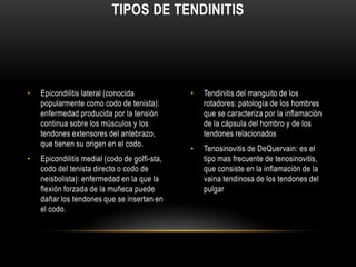 TIPOS DE TENDINITIS




•   Epicondilitis lateral (conocida            •   Tendinitis del manguito de los
    popularmente como codo de tenista):            rotadores: patología de los hombres
    enfermedad producida por la tensión            que se caracteriza por la inflamación
    continua sobre los músculos y los              de la cápsula del hombro y de los
    tendones extensores del antebrazo,             tendones relacionados
    que tienen su origen en el codo.
                                               •   Tenosinovitis de DeQuervain: es el
•   Epicondilitis medial (codo de golfi-sta,       tipo mas frecuente de tenosinovitis,
    codo del tenista directo o codo de             que consiste en la inflamación de la
    neisbolista): enfermedad en la que la          vaina tendinosa de los tendones del
    flexión forzada de la muñeca puede             pulgar
    dañar los tendones que se insertan en
    el codo.
 