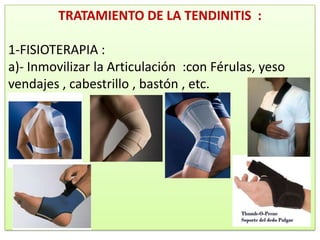 TRATAMIENTO DE LA TENDINITIS :

1-FISIOTERAPIA :
a)- Inmovilizar la Articulación :con Férulas, yeso
vendajes , cabestrillo , bastón , etc.
 
