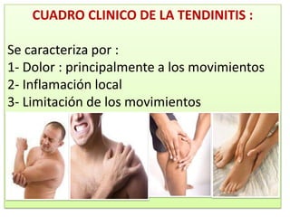 CUADRO CLINICO DE LA TENDINITIS :

Se caracteriza por :
1- Dolor : principalmente a los movimientos
2- Inflamación local
3- Limitación de los movimientos
 