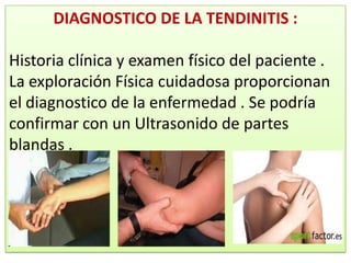 DIAGNOSTICO DE LA TENDINITIS :

Historia clínica y examen físico del paciente .
La exploración Física cuidadosa proporcionan
el diagnostico de la enfermedad . Se podría
confirmar con un Ultrasonido de partes
blandas .
 