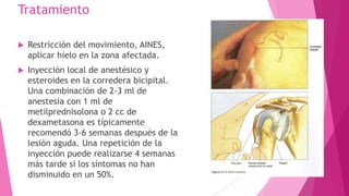Tratamiento


Restricción del movimiento, AINES,
aplicar hielo en la zona afectada.



Inyección local de anestésico y
esteroides en la corredera bicipital.
Una combinación de 2-3 ml de
anestesia con 1 ml de
metilprednisolona o 2 cc de
dexametasona es típicamente
recomendó 3-6 semanas después de la
lesión aguda. Una repetición de la
inyección puede realizarse 4 semanas
más tarde si los síntomas no han
disminuido en un 50%.

 