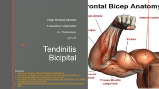 z
z
Tendinitis
Bicipital
Diego Hinojosa Sánchez
Evaluación y Diagnostico
Lic. Fisioterapia.
9/11/17
Bibliografía:
• https://www.clinicalkey.es/#!/content/patient_handout/5-s2.0-
pe_ExitCare_DI_Biceps_Tendon_Tendinitis_Distal_With_Rehab_SportsMed_es
• https://www.clinicalkey.es/#!/content/patient_handout/5-s2.0-
pe_ExitCare_DI_Biceps_Tendon_Tendinitis_Proximal_and_Tenosynovitis_With_Rehab_
SportsMed_es?scrollTo=%23h1.0030
• https://www.barnaclinic.com/blog/traumatologia-deportiva/2016/04/12/lesiones-tendon-
tipos/
 