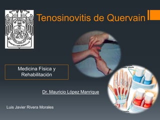 Tenosinovitis de Quervain




      Medicina Física y
       Rehabilitación


                   Dr. Mauricio López Manrique


Luis Javier Rivera Morales
 