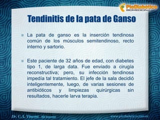 Tendinitis de la pata de Ganso
La pata de ganso es la inserción tendinosa
común de los músculos semitendinoso, recto
interno y sartorio.
Este paciente de 32 años de edad, con diabetes
tipo 1, de larga data. Fue enviado a cirugía
reconstructiva; pero, su infección tendinosa
impedía tal tratamiento. El jefe de la sala decidió
inteligentemente, luego, de varias sesiones de
antibióticos y limpiezas quirúrgicas sin
resultados, hacerle larva terapia.
Dr. VINCENT, M.D