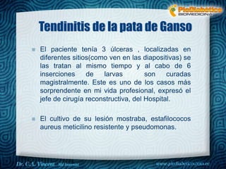 Tendinitis de la pata de Ganso
El paciente tenía 3 úlceras , localizadas en
diferentes sitios(como ven en las diapositivas) se
las tratan al mismo tiempo y al cabo de 6
inserciones de larvas son curadas
magistralmente. Este es uno de los casos más
sorprendente en mi vida profesional, expresó el
jefe de cirugía reconstructiva, del Hospital.
El cultivo de su lesión mostraba, estafilococos
aureus meticilino resistente y pseudomonas.
Dr. VINCENT, M.D
