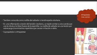  Tambien conocida como rodilla del saltador o tendinopatía rotuliana.
 Es una inflamación o lesión del tendón rotuliano, un tejido similar a una cuerda que
une la rótula a la tibia (hueso de la espinilla). La rodilla de saltador es una lesión por
sobrecarga (movimientos repetidos que causan irritación o daño.
 Suprapatelar e infrapatelar
Infrapatelar
mas común
 