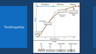 Tendinopatías
Fisiológico Sobreuso Rotura
 