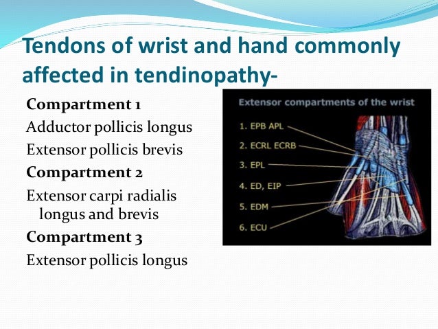 Tendinopathies of wrist and hand