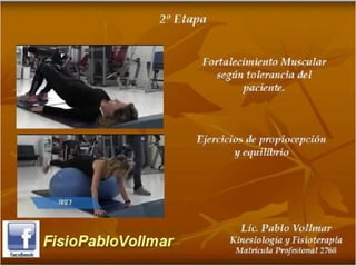 tendinopatia glutea tendinitis de cadera.PDF