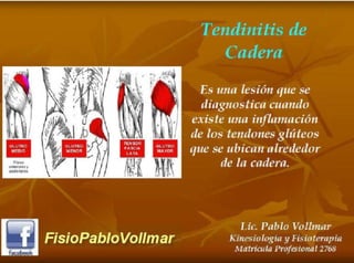 tendinopatia glutea tendinitis de cadera.PDF