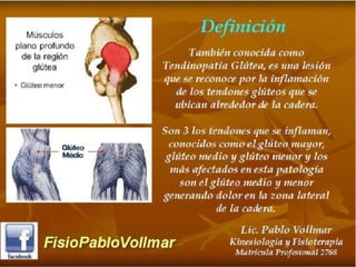 tendinopatia glutea tendinitis de cadera.PDF