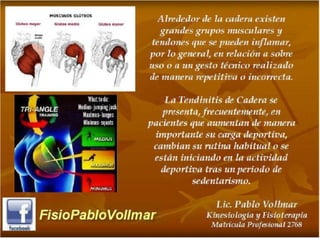 tendinopatia glutea tendinitis de cadera.PDF