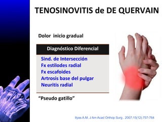 TENOSINOVITIS de DE QUERVAIN

Dolor inicio gradual

    Diagnóstico Diferencial
Cara radial de la muñeca
 Sind. de Interse...