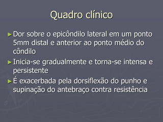 Quadro clínico
►Dor sobre o epicôndilo lateral em um ponto
5mm distal e anterior ao ponto médio do
côndilo
►Inicia-se gradualmente e torna-se intensa e
persistente
►É exacerbada pela dorsiflexão do punho e
supinação do antebraço contra resistência
 