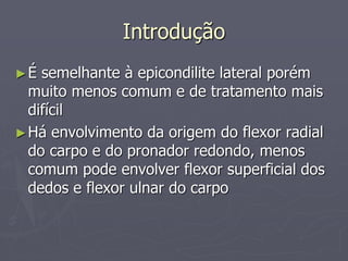 Introdução
►É semelhante à epicondilite lateral porém
muito menos comum e de tratamento mais
difícil
►Há envolvimento da origem do flexor radial
do carpo e do pronador redondo, menos
comum pode envolver flexor superficial dos
dedos e flexor ulnar do carpo
 