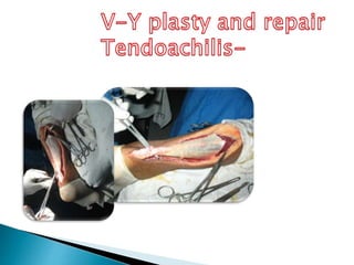 Tendo achilles inflammation and rupture