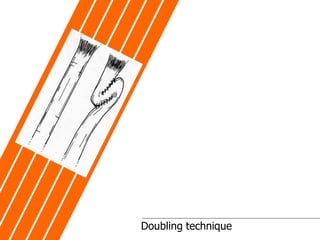 Doubling technique
 
