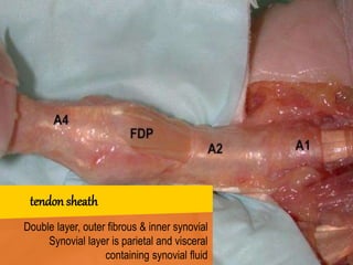 Double layer, outer fibrous & inner synovial
Synovial layer is parietal and visceral
containing synovial fluid
tendon sheath
 