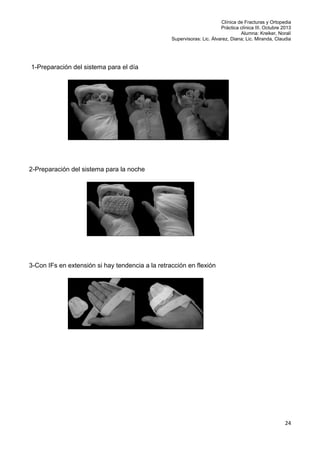 Clínica de Fracturas y Ortopedia
Práctica clínica III. Octubre 2013
Alumna: Kreiker, Noralí
Supervisoras: Lic. Álvarez, Diana; Lic. Miranda, Claudia

1-Preparación del sistema para el día

2-Preparación del sistema para la noche

3-Con IFs en extensión si hay tendencia a la retracción en flexión

24

 