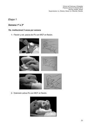 Clínica de Fracturas y Ortopedia
Práctica clínica III. Octubre 2013
Alumna: Kreiker, Noralí
Supervisoras: Lic. Álvarez, Diana; Lic. Miranda, Claudia

Etapa 1
Semana 1ª a 3ª
Tto. institucional 3 veces por semana
1- Flexión y ext. pasiva de IFs con MCF en flexión.

2- Extensión activa IFs con MCF en flexión.

25

 
