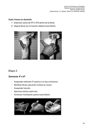 Clínica de Fracturas y Ortopedia
Práctica clínica III. Octubre 2013
Alumna: Kreiker, Noralí
Supervisoras: Lic. Álvarez, Diana; Lic. Miranda, Claudia

Cada 2 horas en domicilio
1- Extensión activa de IFP e IFD dentro de la férula
2- Dejarse llevar por la tracción elástica hacia flexión

Etapa 2
Semanas 4ª a 8ª
-

Suspender extensión IF pasiva si no hay contractura.

-

Modificar férula colocando muñeca en neutro.

-

Suspender tracción.

-

Ejercicios activos cada hora.

-

Continuar movilización pasiva hacia flexión.

26

 