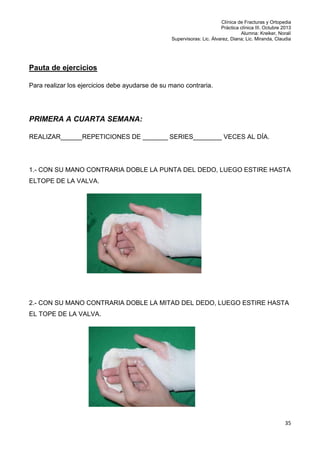 Clínica de Fracturas y Ortopedia
Práctica clínica III. Octubre 2013
Alumna: Kreiker, Noralí
Supervisoras: Lic. Álvarez, Diana; Lic. Miranda, Claudia

Pauta de ejercicios
Para realizar los ejercicios debe ayudarse de su mano contraria.

PRIMERA A CUARTA SEMANA:
REALIZAR______REPETICIONES DE _______ SERIES________ VECES AL DÍA.

1.- CON SU MANO CONTRARIA DOBLE LA PUNTA DEL DEDO, LUEGO ESTIRE HASTA
ELTOPE DE LA VALVA.

2.- CON SU MANO CONTRARIA DOBLE LA MITAD DEL DEDO, LUEGO ESTIRE HASTA
EL TOPE DE LA VALVA.

35

 