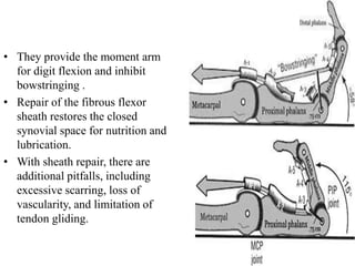 Tendon healing and tendon grafting | PPTX