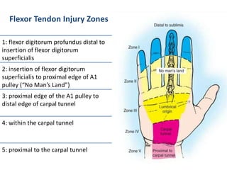 tendon-injuries-of-hand-pptx