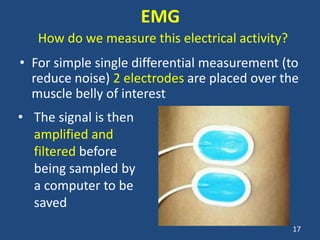 EMG
   How do we measure this electrical activity?
• For simple single differential measurement (to
  reduce noise) 2 electrodes are placed over the
  muscle belly of interest
• The signal is then
  amplified and
  filtered before
  being sampled by
  a computer to be
  saved
                                                 17
 