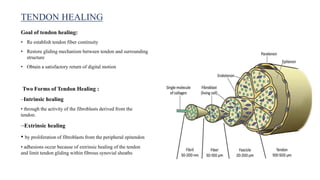Goal of tendon healing:
• Re establish tendon fiber continuity
• Restore gliding mechanism between tendon and surrounding
structure
• Obtain a satisfactory return of digital motion
Two Forms of Tendon Healing :
–Intrinsic healing
• through the activity of the fibroblasts derived from the
tendon.
–Extrinsic healing
• by proliferation of fibroblasts from the peripheral epitendon
• adhesions occur because of extrinsic healing of the tendon
and limit tendon gliding within fibrous synovial sheaths
TENDON HEALING
 