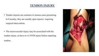 • Tendon injuries are common in trauma cases presenting
to Casualty; they are usually open injuries requiring
surgical intervention.
• The neurovascular injury may be associated with the
tendon injury, so have to r/o NVB injury before repairing
tendon.
TENDON INJURY
 