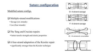 Suture configuration
Modified suture configs.
 Multiple-strand modifications
• Savage (six strands)
• Lee (four strands)
 The Tang and Cruciate repairs
• better tensile strength and elastic properties
 A four-strand adaptation of the Kessler repair
• significantly stronger than the Kessler technique
 